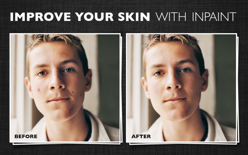 Improve your skin with Inpaint
