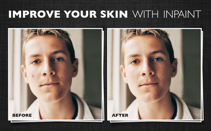 Improve your skin with Inpaint