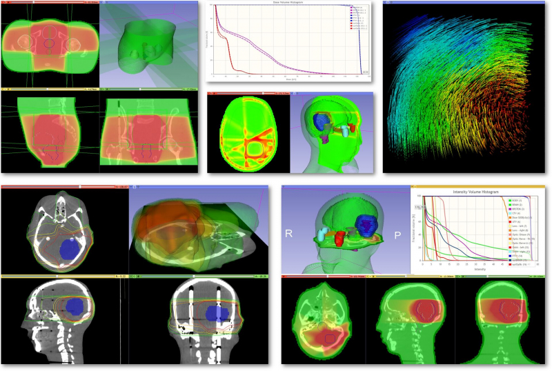 Adaptive radiation therapy